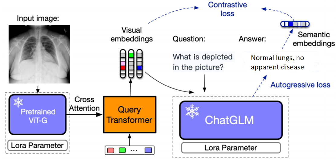 XrayGLM: Summarizing Chest X-ray Reports Using a Large Medical Visual Language Model